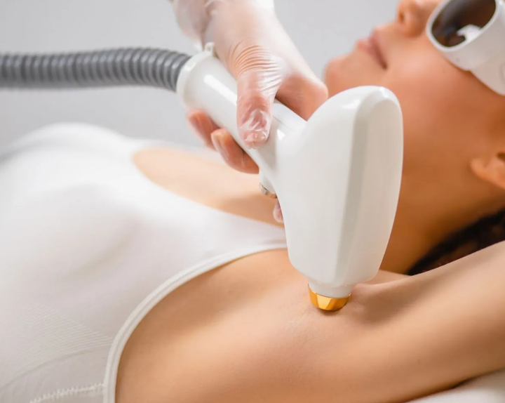 Epilazione laser Epilazione laser