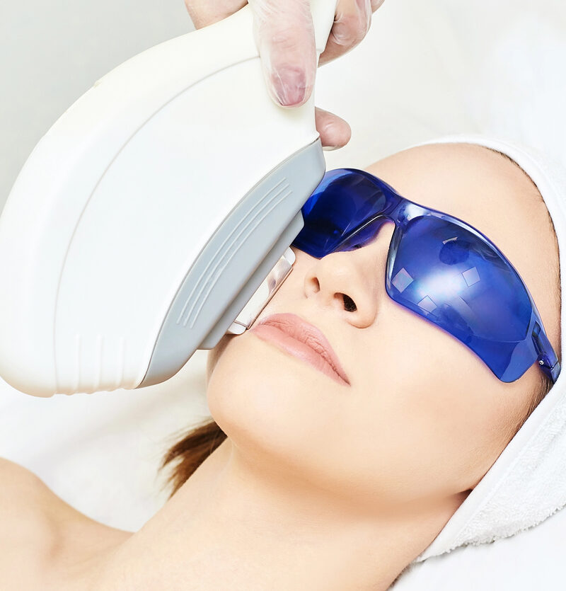 Epilazione laser epilazione definitiva Sesto San Giovanni